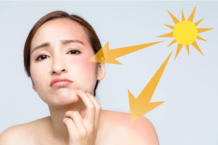 Lựa chọn sản phẩm chống nắng phù hợp với từng loại da