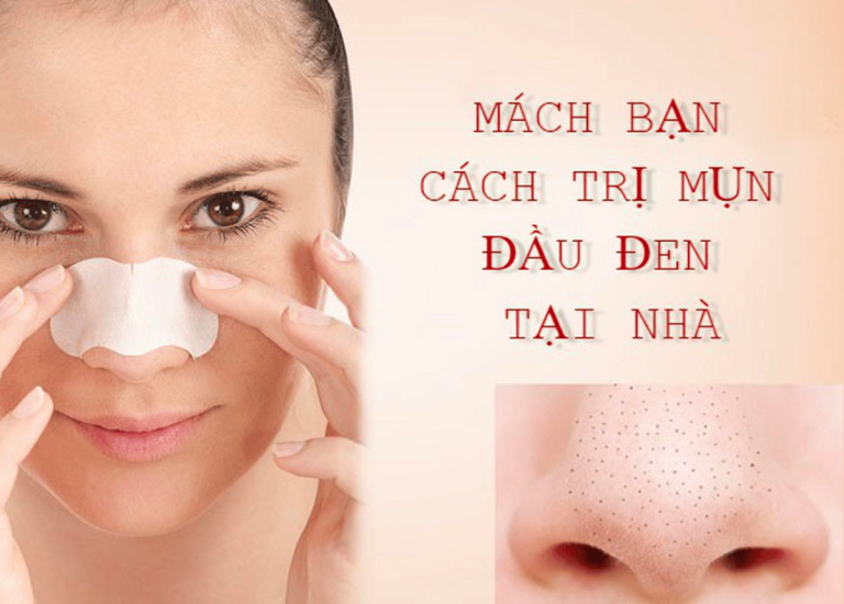 Nguyên nhân và cách trị mụn đầu đen trên mặt hiệu quả