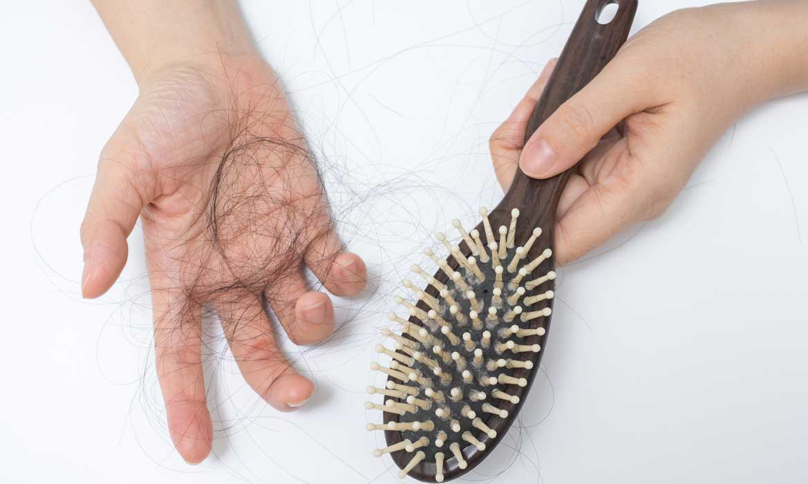 Rụng tóc là dấu hiệu mang thai tuần đầu thường gặp