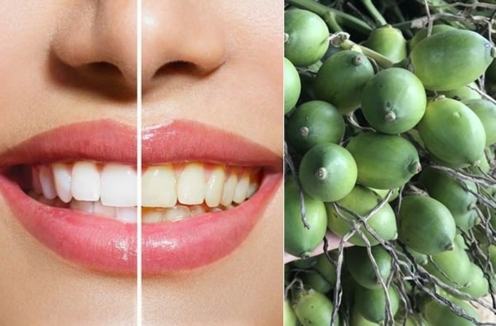 Phương pháp tẩy trắng răng an toàn bằng trái cau rất đơn giản 