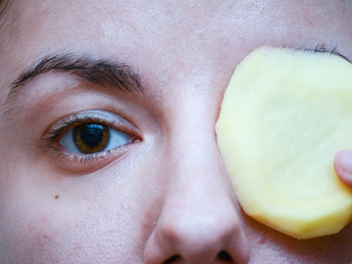 如何用土豆治疗黑眼圈 