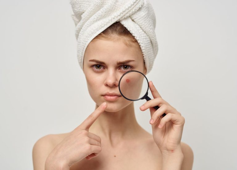 Các bước skincare cho da mụn đúng chuẩn, an toàn 