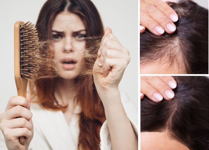 cách trị rụng tóc