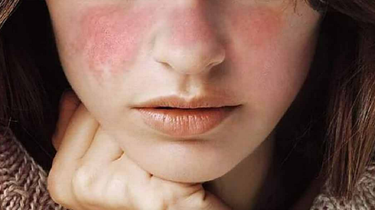 Tránh rửa mặt bằng nước vo gạo khi da bị kích ứng nếu như chưa chắc chắn rằng da mặt của bạn có phù hợp với loại nước này hay không 