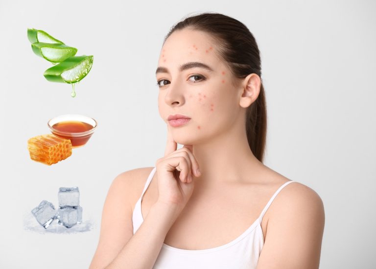 Nguyên nhân và cách điều trị mụn viêm đỏ tại nhà&nbsp;