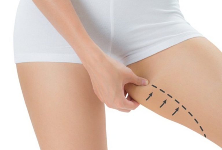 16 Cách giảm mỡ đùi hiệu quả tại nhà, an toàn, nhanh chóng