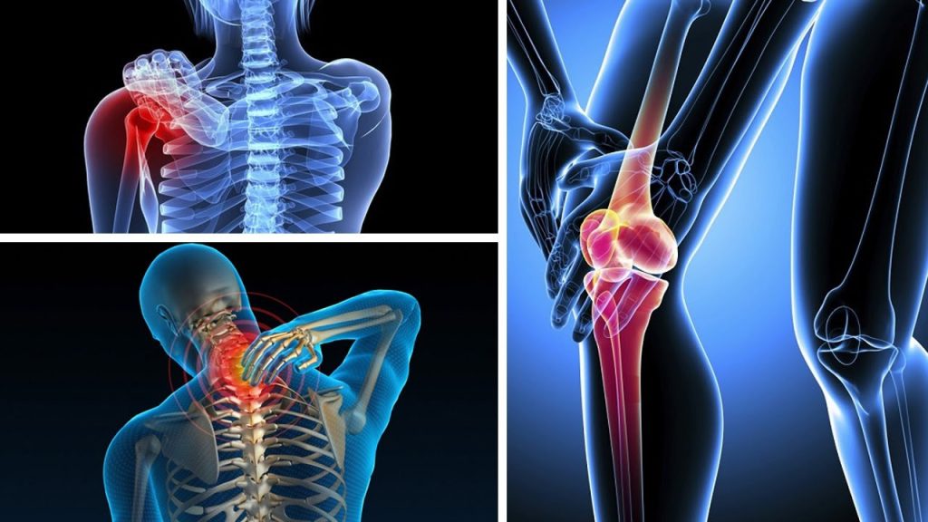 Gừng còn có tác dụng giảm đau nhức xương khớp