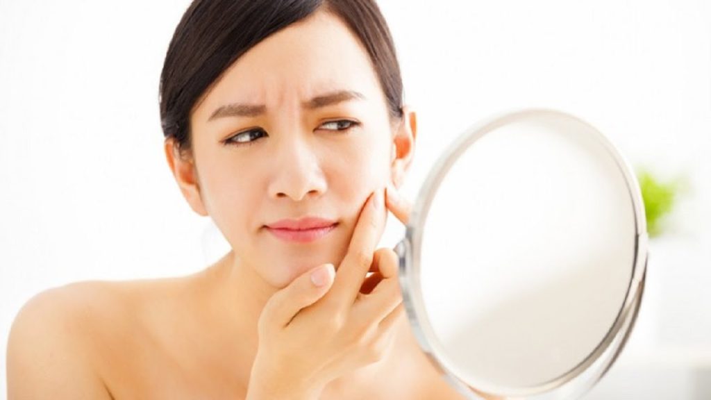 Điều trị mụn trứng cá hiệu quả