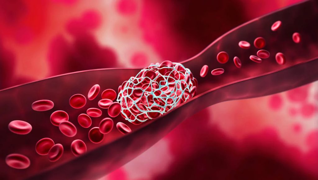 Hàm lượng lớn vitamin K trong rau chân vịt làm loãng máu