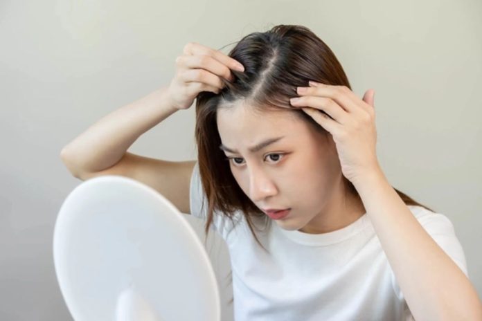 Dầu gội cho tóc dầu