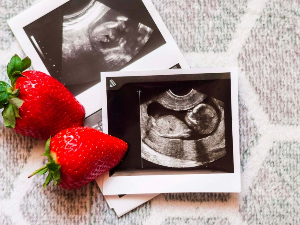 Chi phí thụ tinh ống nghiệm IVF bao nhiêu tiền?