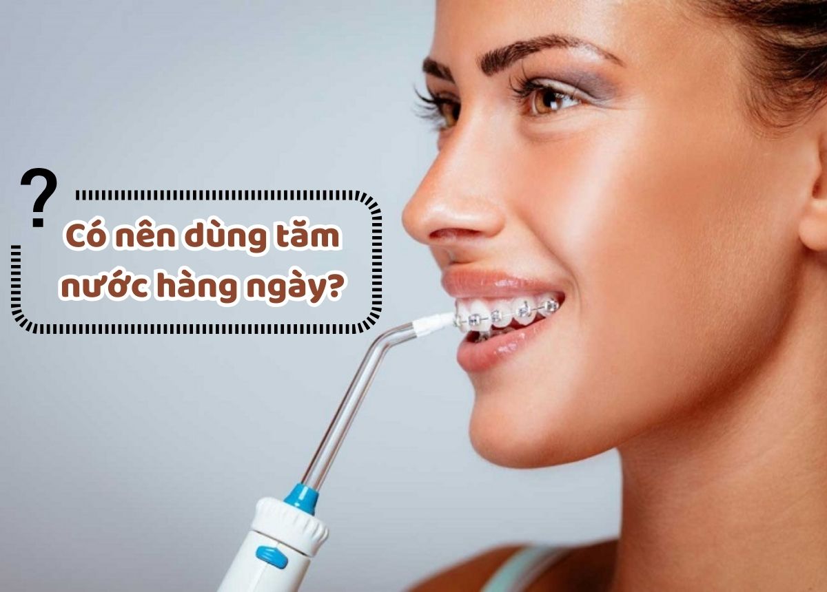 Có nên dùng tăm nước không? 8 Lợi ích và lưu ý khi sử dụng chăm sóc răng miệng