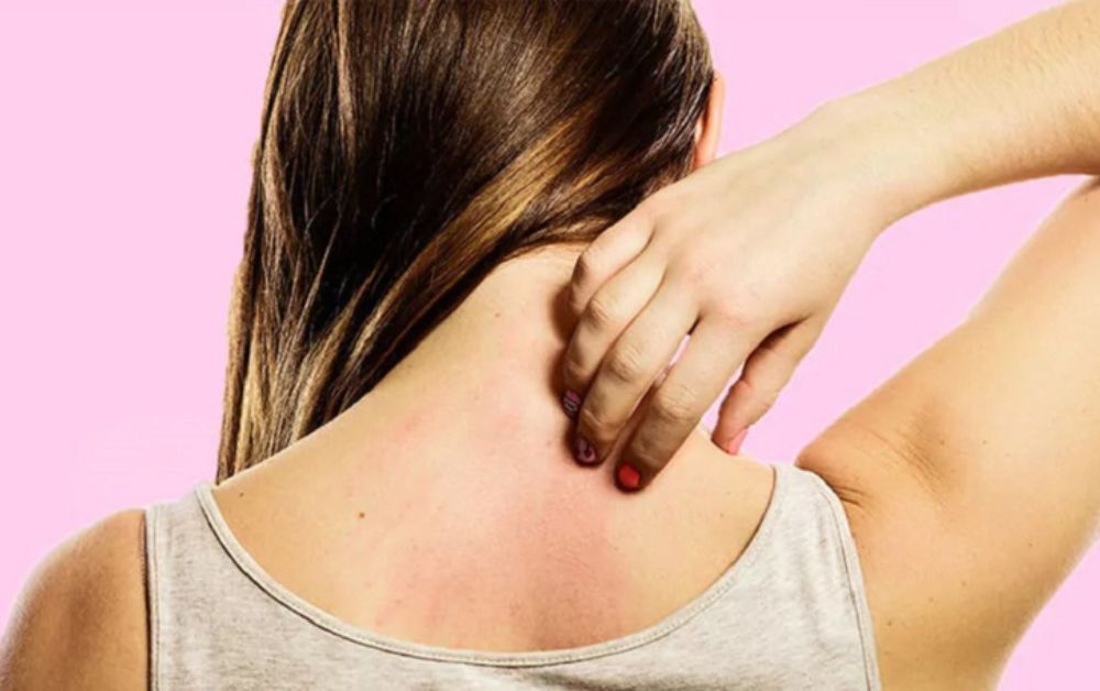 Vitamin B1 cũng có thể gây dị ứng da