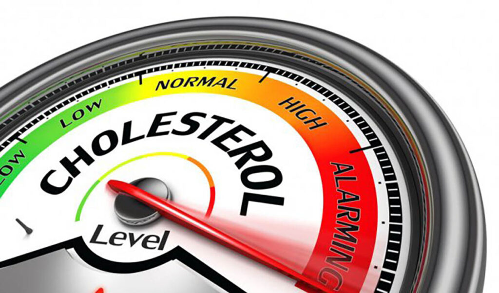 Tăng cholesterol