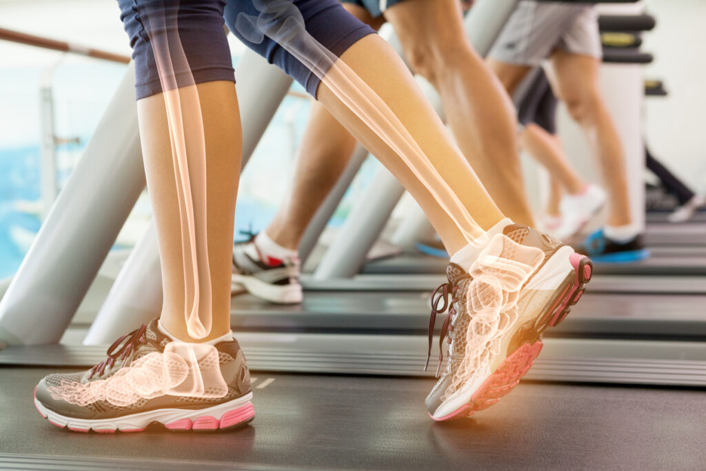Uống sữa tươi không đường giúp tăng mật độ xương