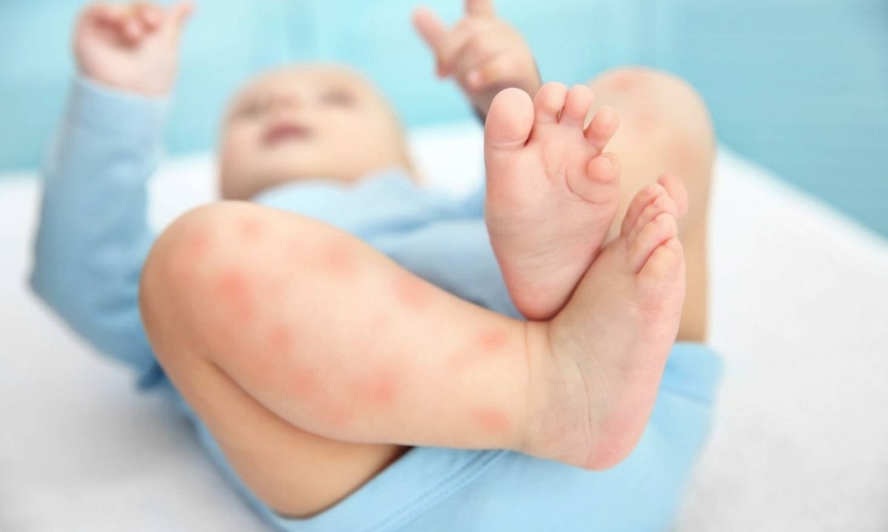 Các dấu hiệu của bệnh nhiễm trùng da Các dấu hiệu của bệnh nhiễm trùng da