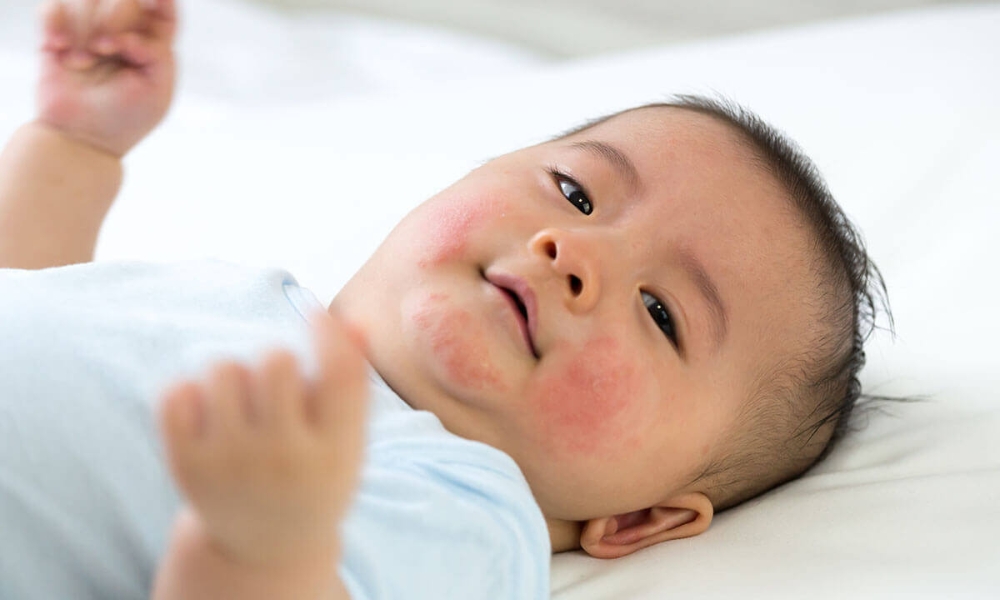 Chú ý vệ sinh cho trẻ Chú ý vệ sinh cho trẻ