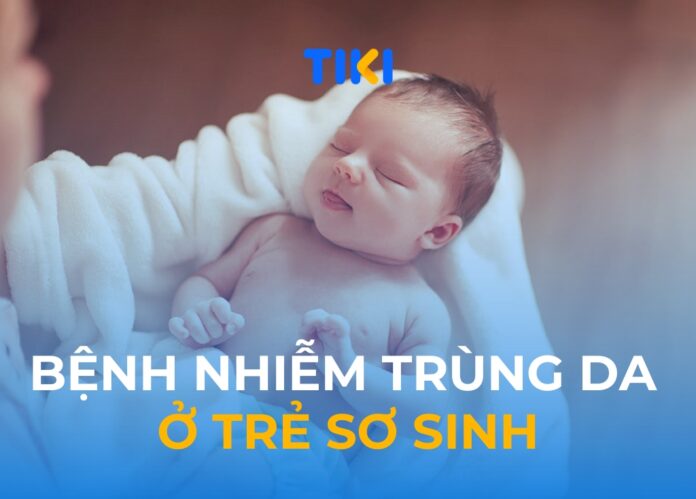 Bệnh nhiễm trùng da ở trẻ sơ sinh