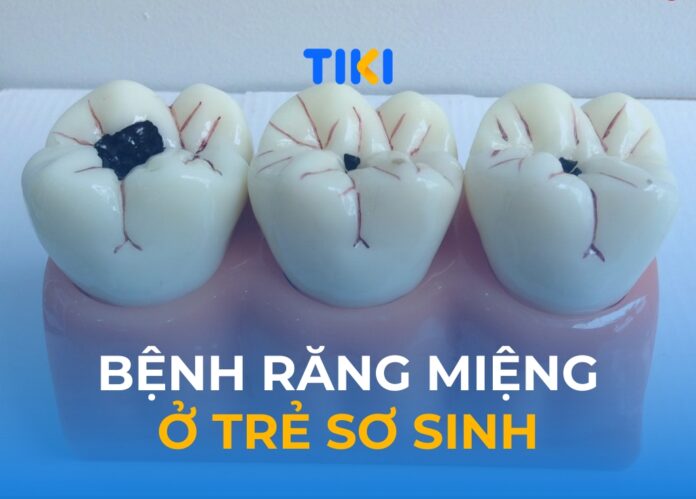 Bệnh răng miệng ở trẻ sơ sinh