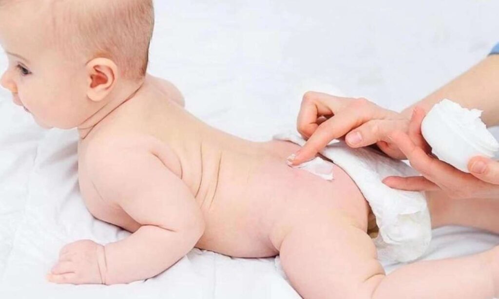 Tắm rửa và luôn giữ cho làn da bé được sạch sẽ Tắm rửa và luôn giữ cho làn da bé được sạch sẽ