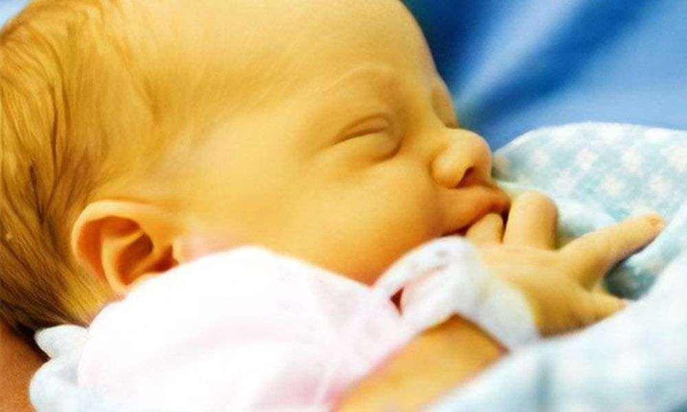 Da vàng trong tình trạng kéo dài là dấu hiệu cho thấy trẻ đang bị bệnh vàng da