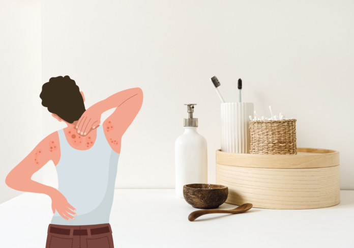 Sữa tắm viêm da cơ địa