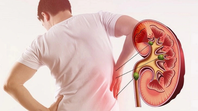 Người mắc bệnh thận cần tham khảo ý kiến bác sĩ trước khi ăn gạo lứt