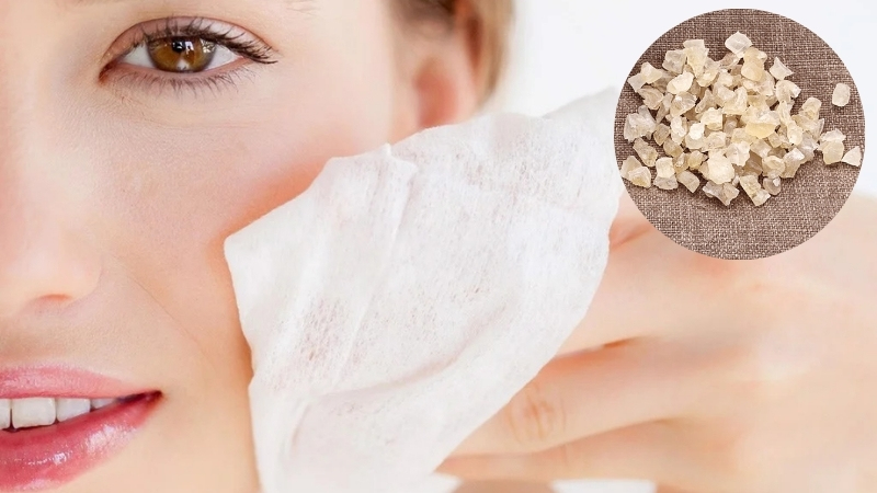 Mủ trôm giúp giải độc và hạn chế mụn nhọt