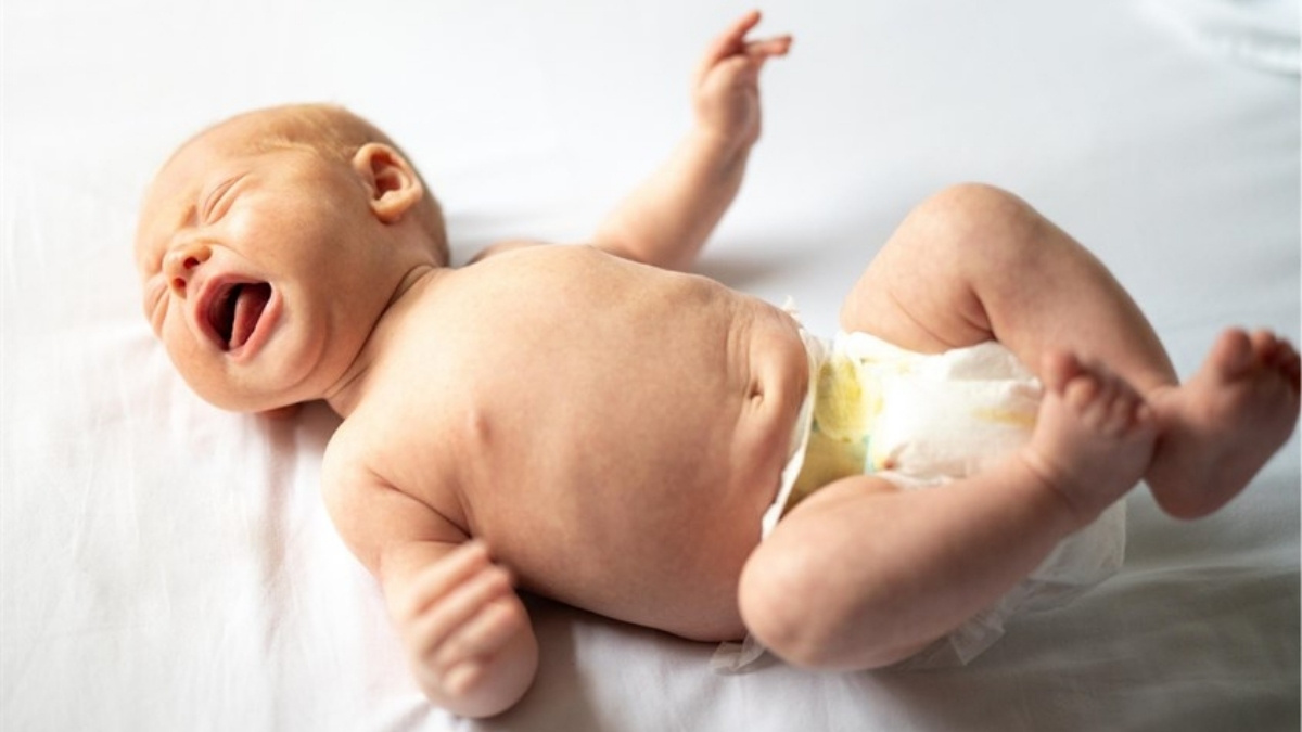Mặc tã quá chật, kích thước không phù hợp là nguyên nhân làm trẻ bị hăm tã