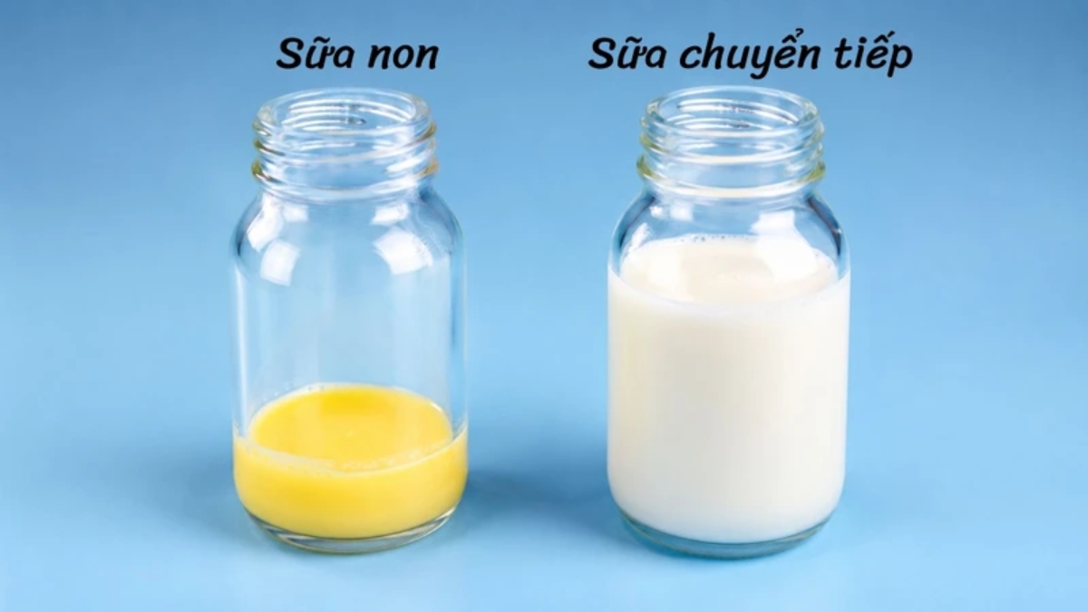 Sữa non thường có màu vàng nhạt, vàng cam hoặc trắng đục tùy cơ địa