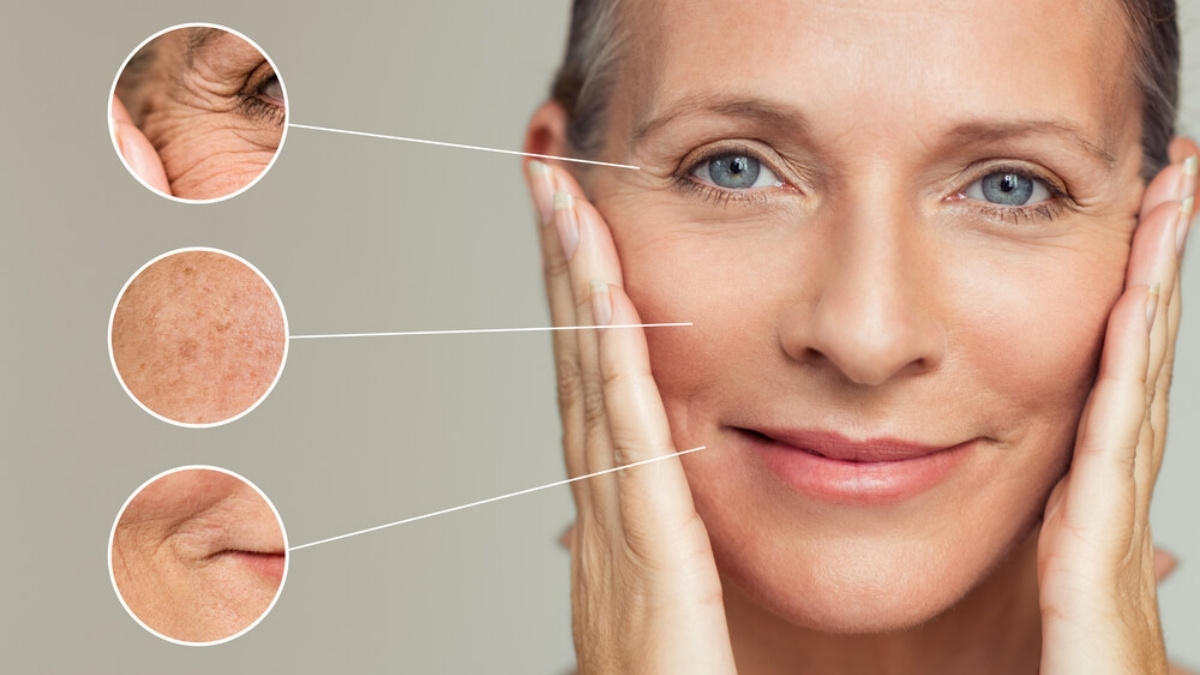 Thiếu Ceramide dễ hình thành nếp nhăn và mất độ đàn hồi