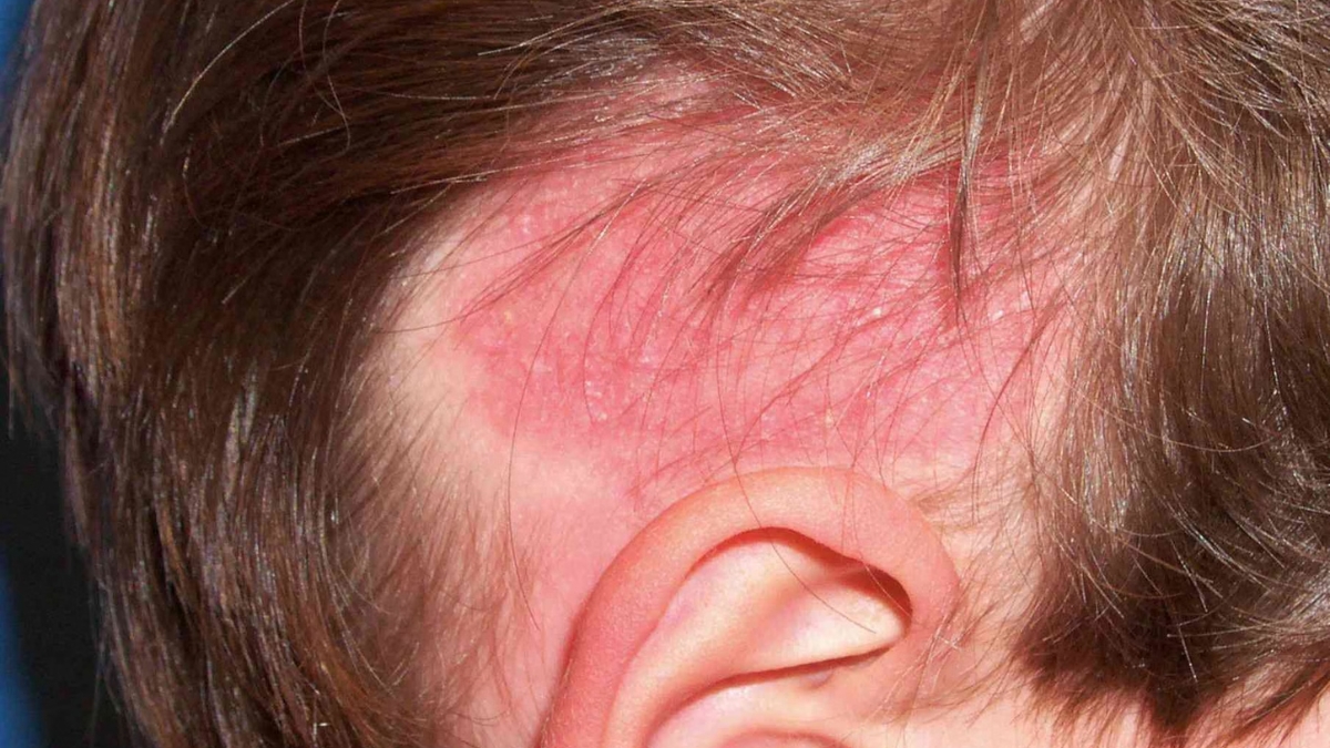 Ngừng sử dụng nếu có dấu hiệu bất thường