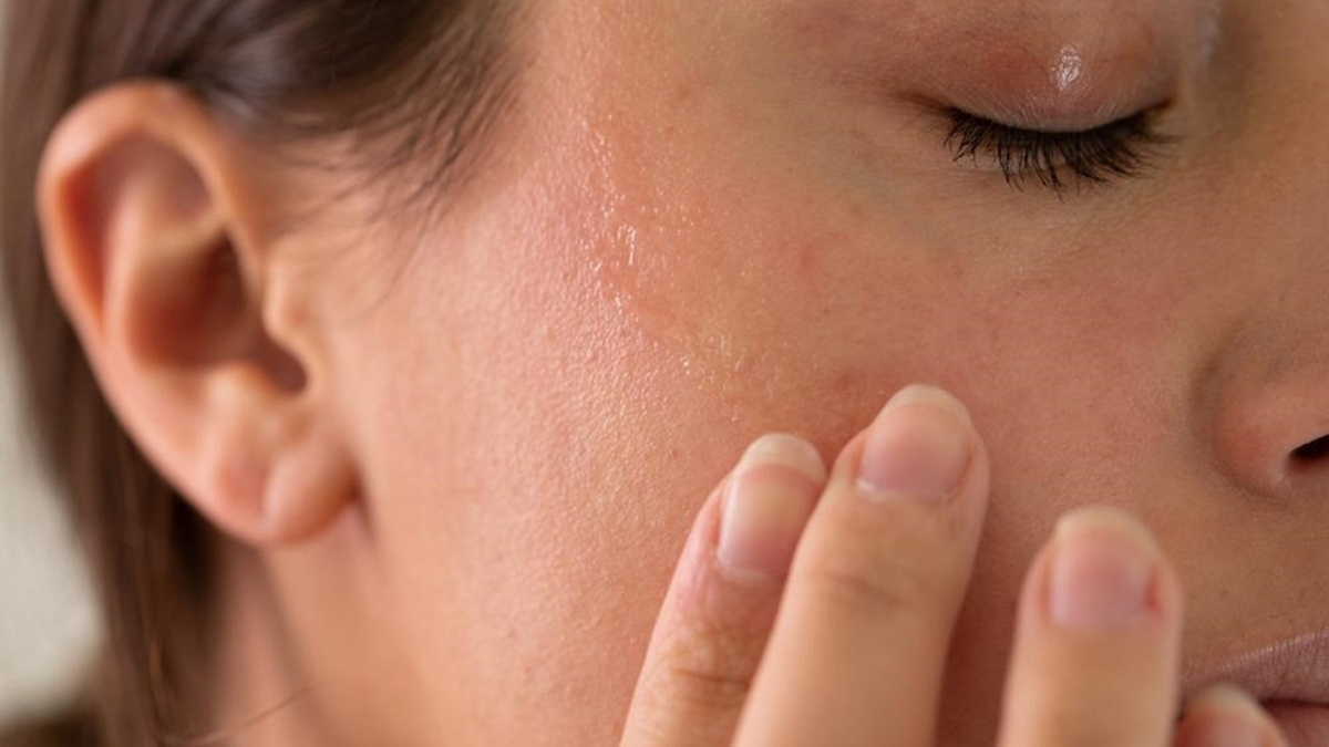 Bề mặt da sần sùi, thô ráp là dấu hiệu da đang thiếu Ceramide
