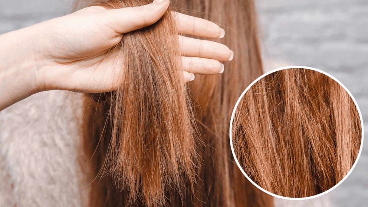 Khi không được cung cấp đủ dinh dưỡng, tóc có xu hướng dễ gãy rụng