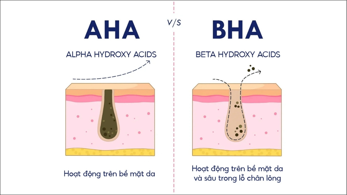 Ưu tiên hoạt chất hỗ trợ làm sạch sâu và kiểm soát bã nhờn như AHA, BHA
