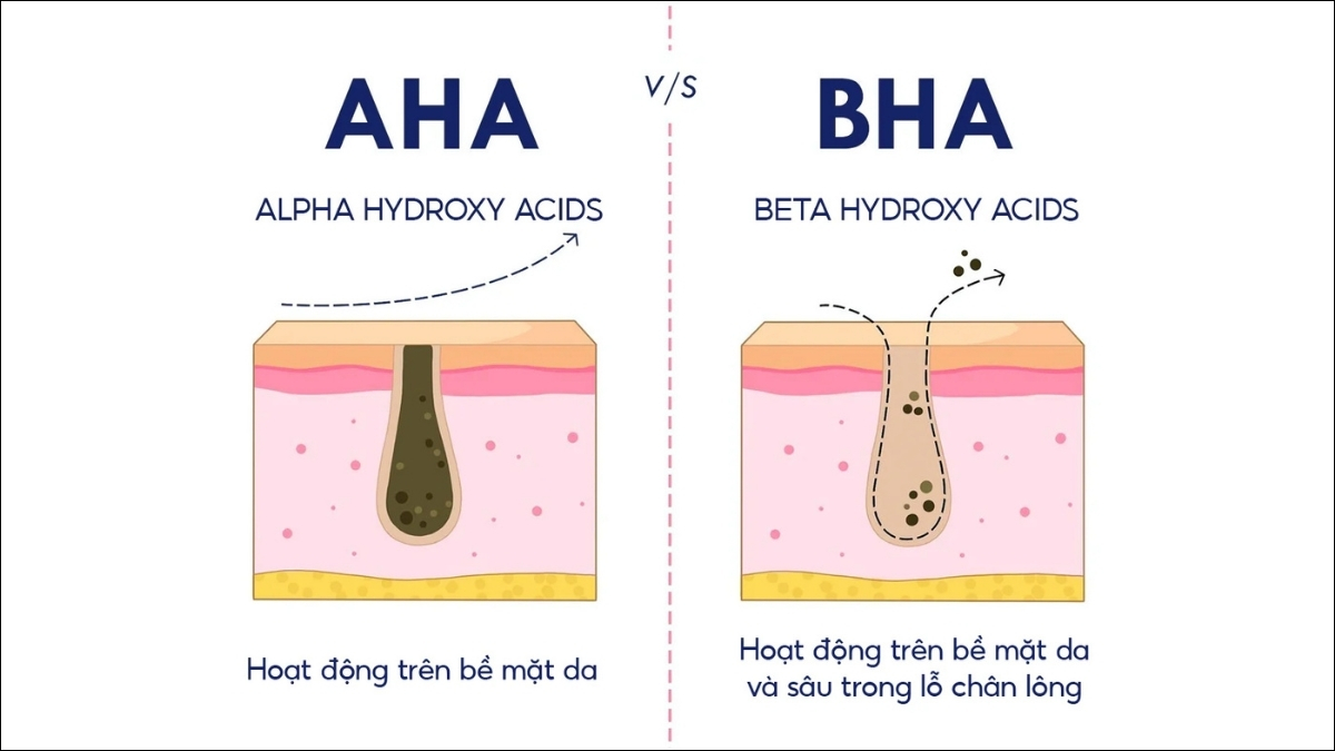 BHA hòa tan bã nhờn sâu trong lỗ chân lông